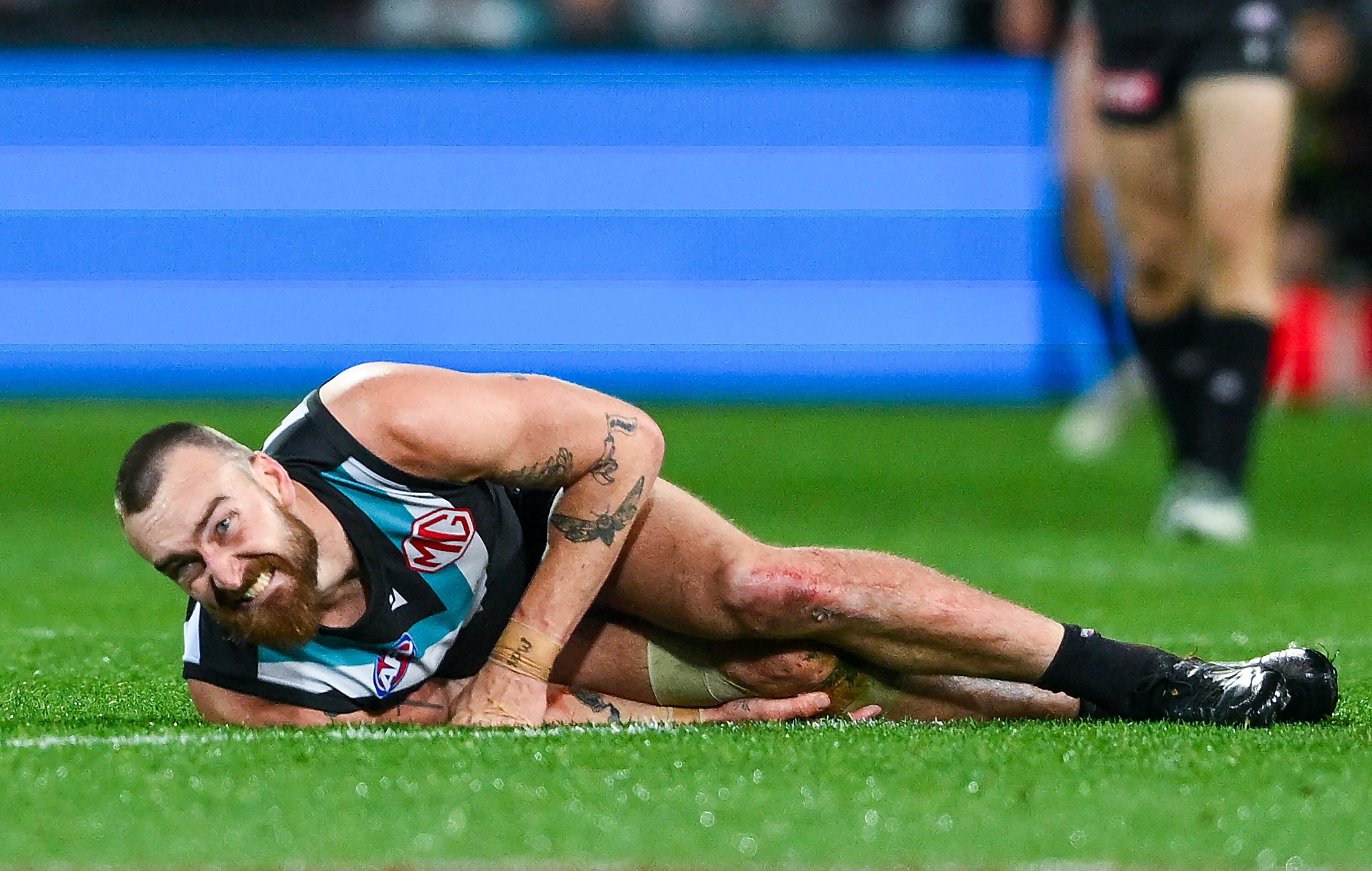 Port dealt two further blows, ruckman to have surgery