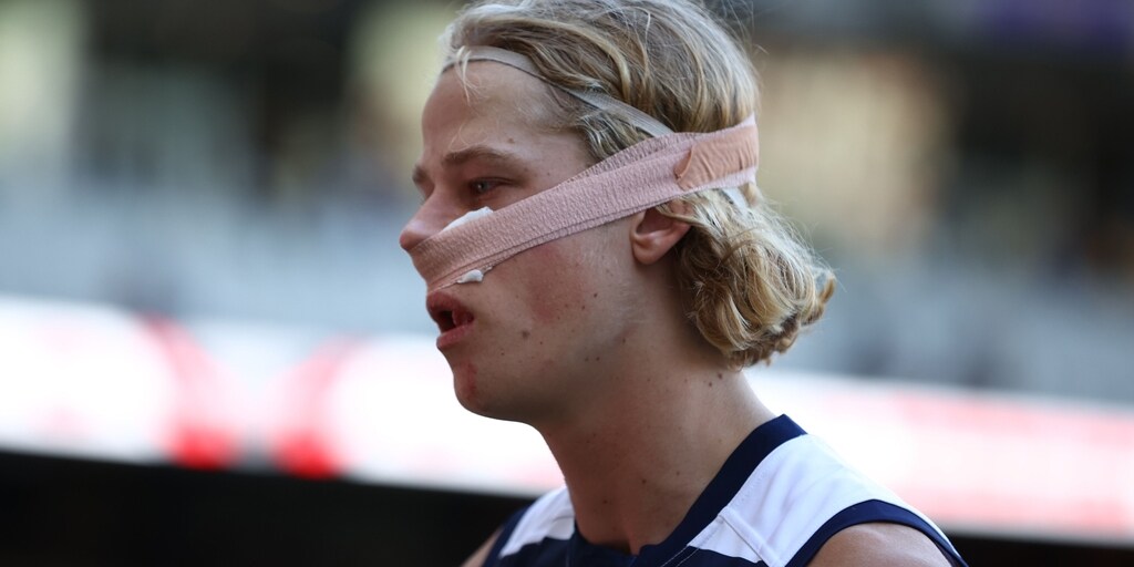 Surgery sidelines Geelong Cats tall Sam De Koning ahead of Adelaide Crows clash - Vimarsana News
