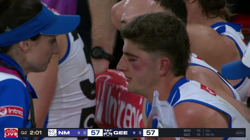 Big blow as star Roo ruled out with gruesome cheek injury
